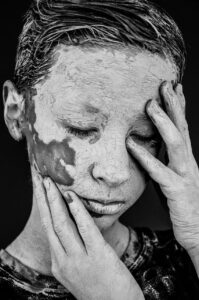 眉アートメイクで色素沈着を防止するためのポイントは？